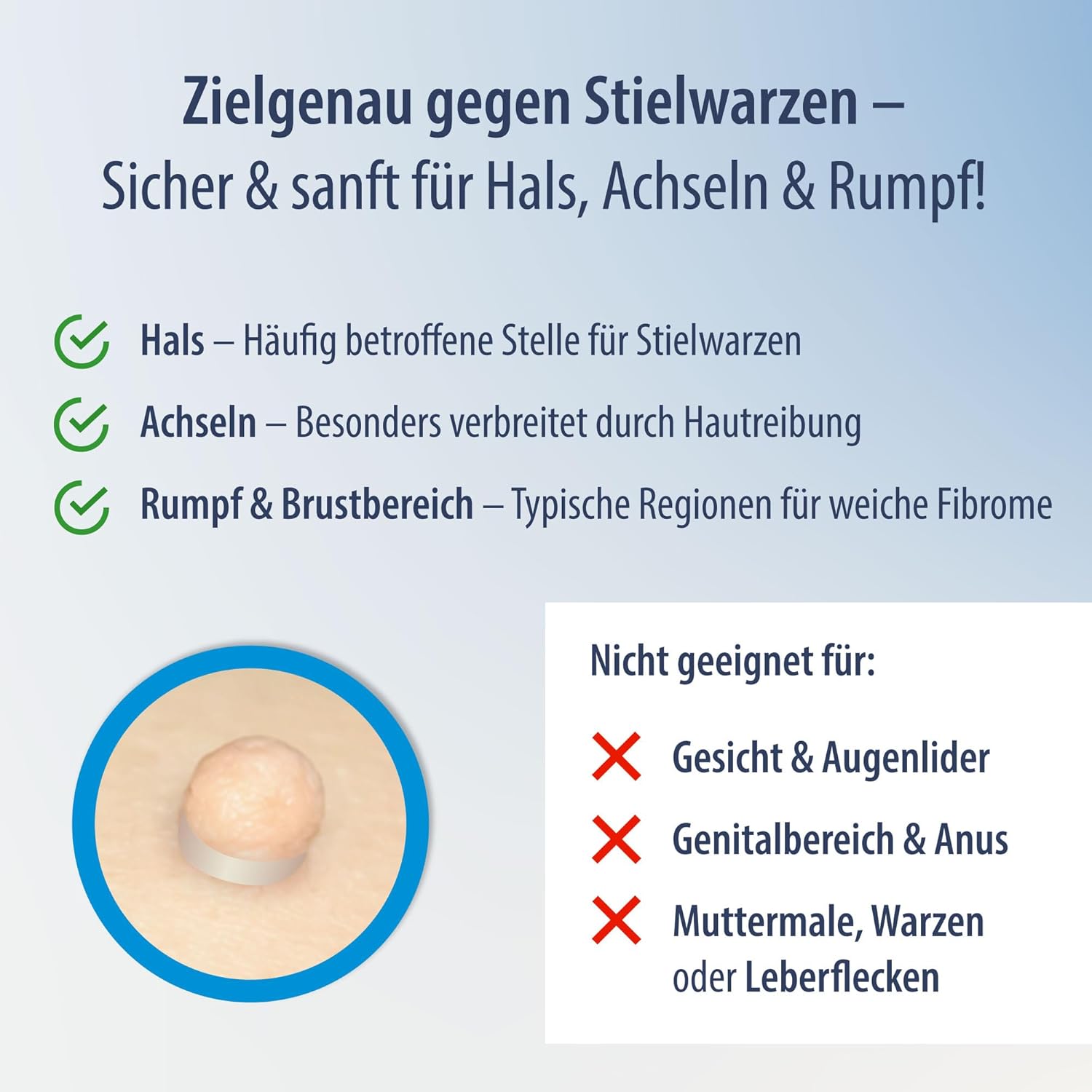 Set zur Entfernung großer & kleiner Stielwarzen mit Tupfern - Skin Tag Remover