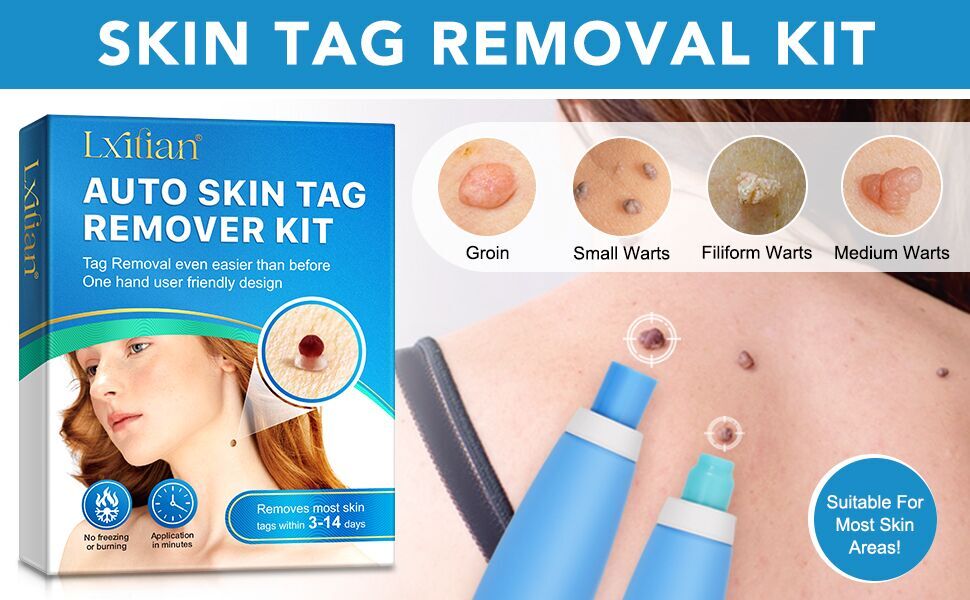 Set zur Entfernung großer & kleiner Stielwarzen mit Tupfern - Skin Tag Remover