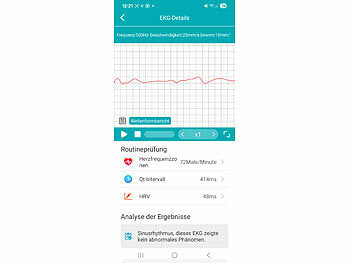 Vitaluhr mit Bluetooth, EKG-Anzeige, Telefonfunktion, App, AMOLED,IP67