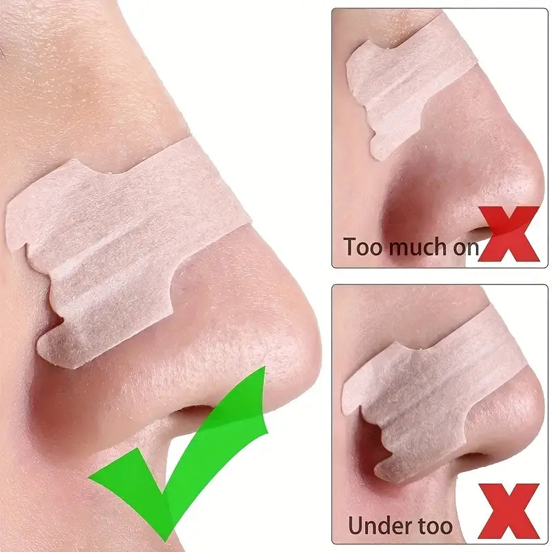 Nasenpflaster - Lindert Sofort Verstopfte Nase, Reduziert Schnarchen, Atmung